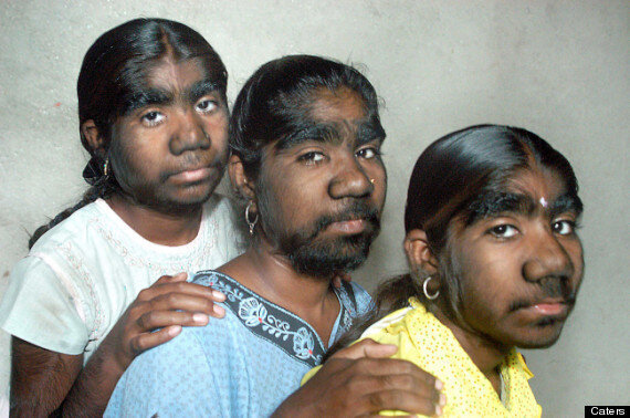 Hairy Indian Women